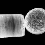 Electron microscope image of diatoms – Nils Kröger at TU Dresden.
