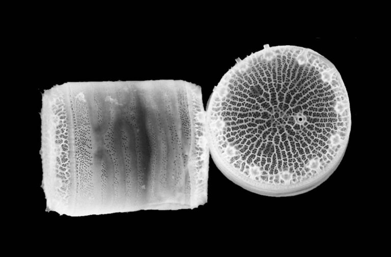 Electron microscope image of diatoms – Nils Kröger at TU Dresden.