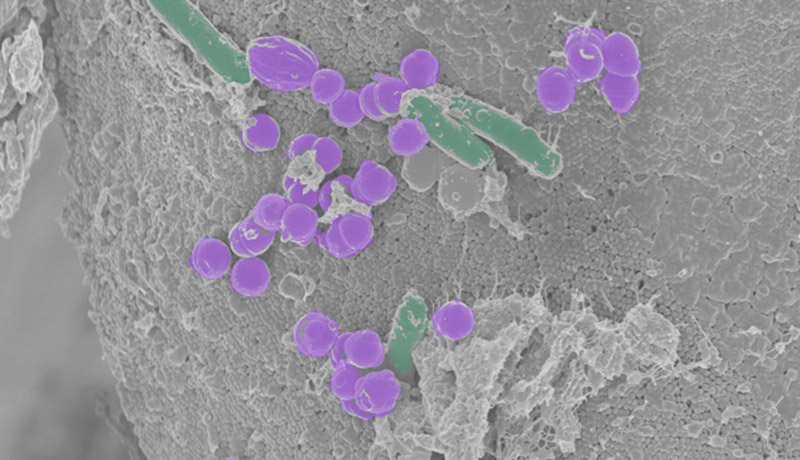 A microscopic image depicting purple spheres among cylindrical, green rods against a textured grey background