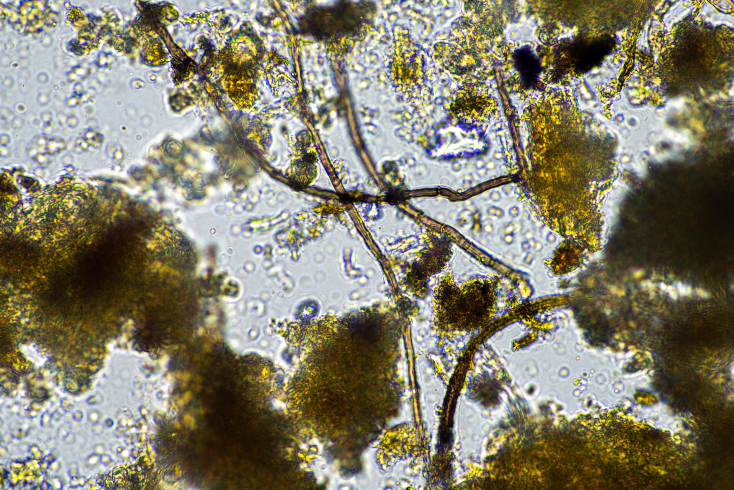 Featured image for “Tiny Soil Microbes May Hold Big Clues About a Warming Arctic”